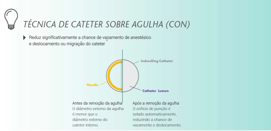 Kit Cateter de Plexo Continuo E Cath Kit Cateter de Plexo Contínuo E-Cath 
